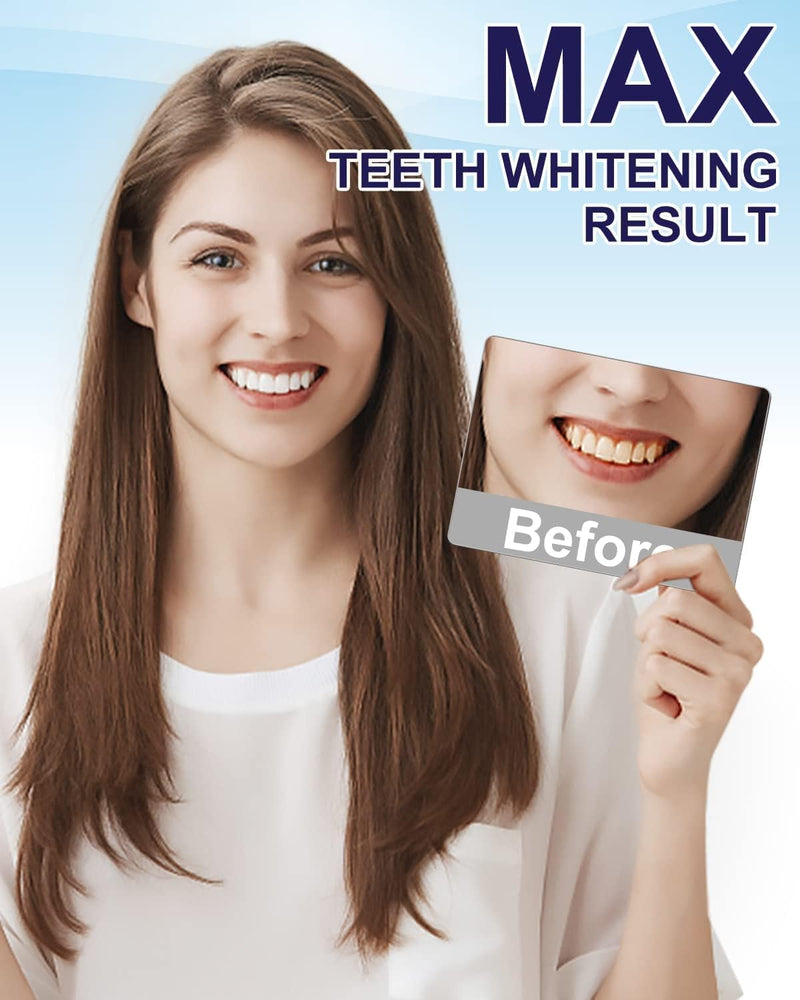 💥Last Day Sale 49% OFF🔥GlorySmile Pro Teeth Whitening Set