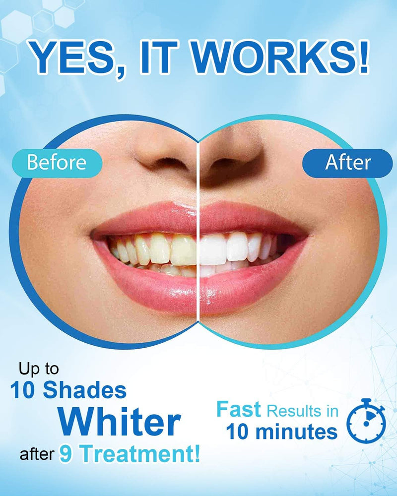 💥Last Day Sale 49% OFF🔥GlorySmile Pro Teeth Whitening Set