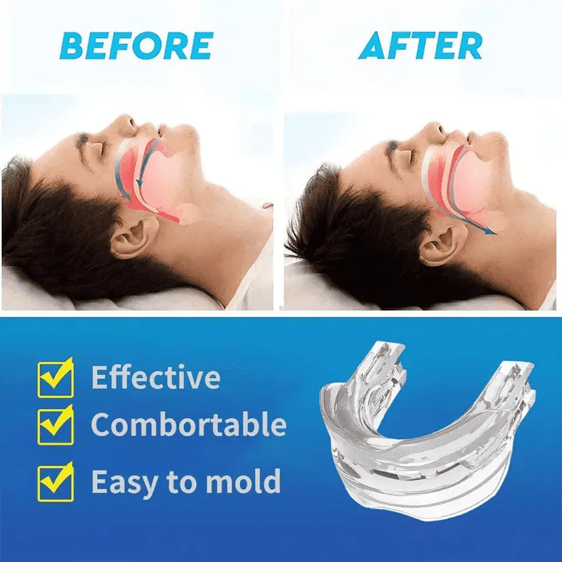 Anti Snore Mouthpiece ( BUY 2 GET FREE SHIPPING)