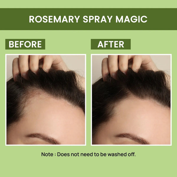 ROSEMARY WATER, HAIR SPRAY FOR REGROWTH (BUY 1 GET 1 FREE) |