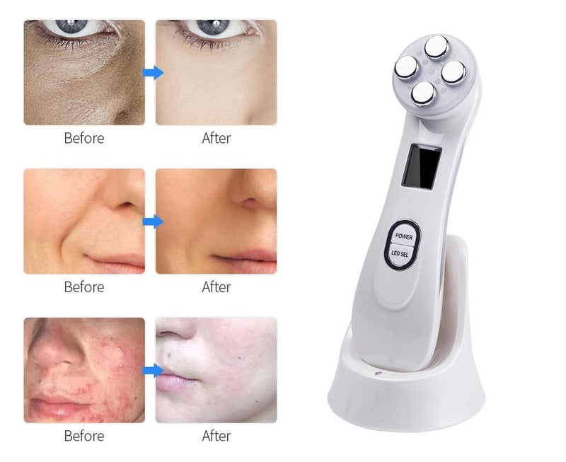 LED Face Lifting Massager