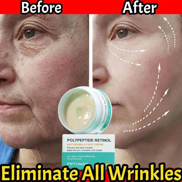 CalesCare ™  40% off Anti-Wrinkle Face Cream Instant Anti Aging for Oily Skin - BUY 2 GET 1 FREE