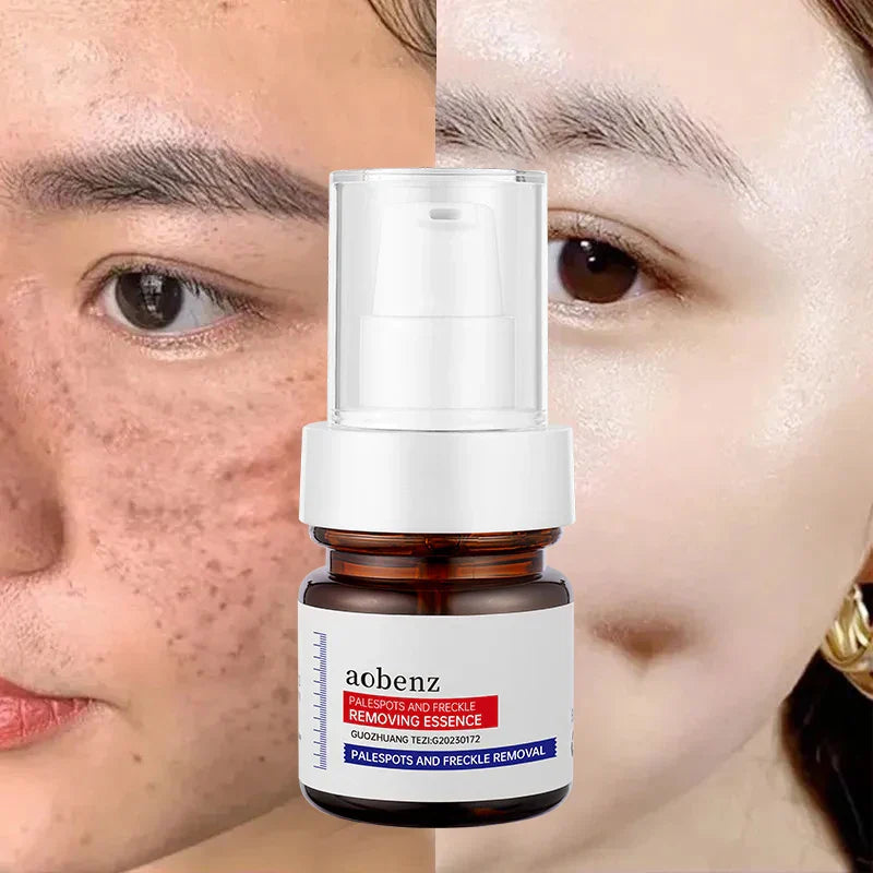 🔥【Limited time offer, buy 1 get 1 free, only $13 each】🔥Vitamin C Whitening Freckles Face Cream Remove Melasma Dark Spots Lighten Melanin