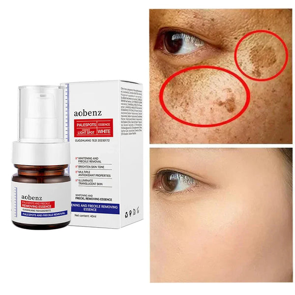 🔥【Limited time offer, buy 1 get 1 free, only $13 each】🔥Vitamin C Whitening Freckles Face Cream Remove Melasma Dark Spots Lighten Melanin