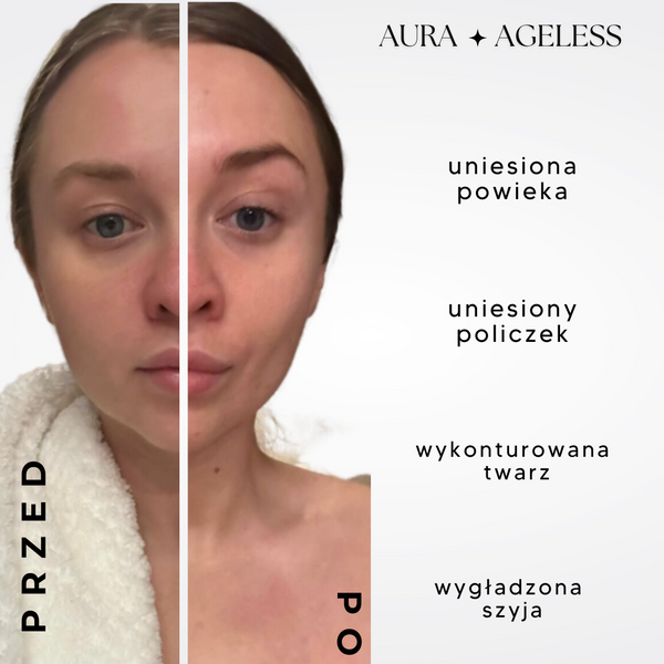 AURA RF masażer liftingujący 3D, wygładzający stymulator kolagenu, Anti Aging z falami RF i terapią LED + APP